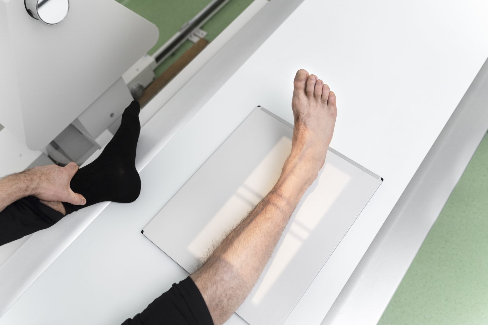 high angle patient getting leg scan - Skinnebensbetændelse: Kom tilbage til løb uden smerter - Smertefribevægelse