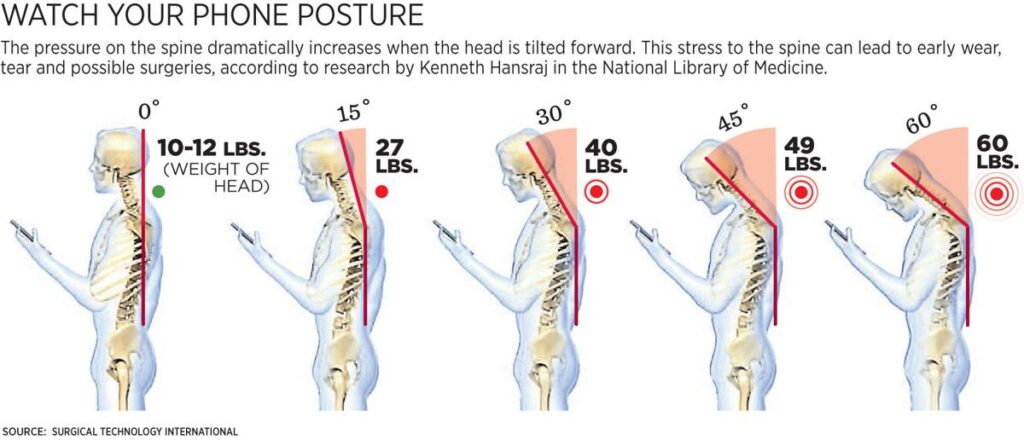 Text neck nocebo - Holdning, kropsbygning og smerter - Smertefribevægelse